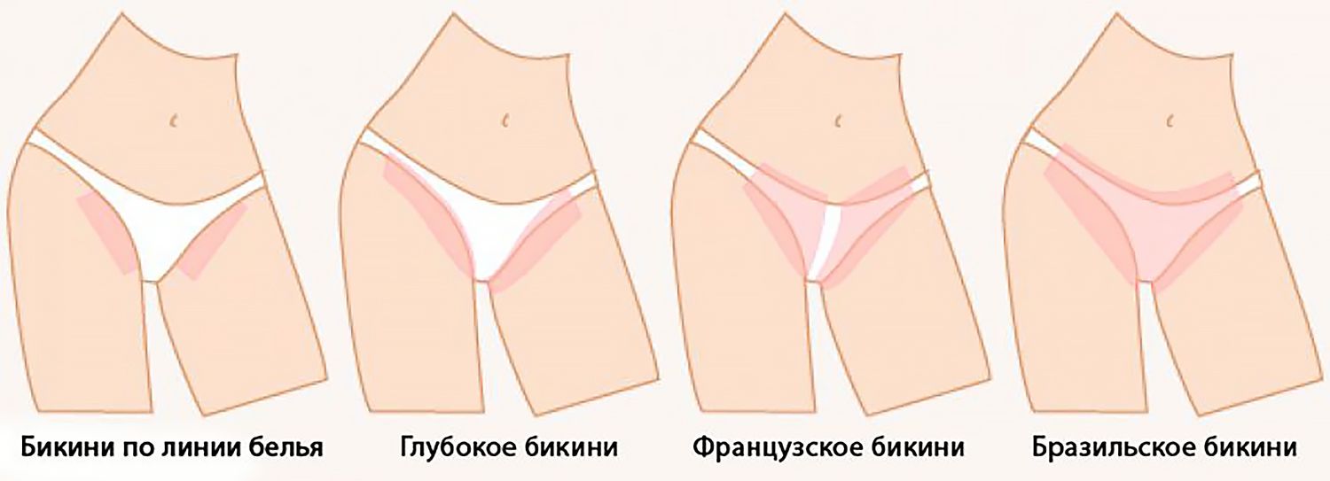 Bikini different type wax