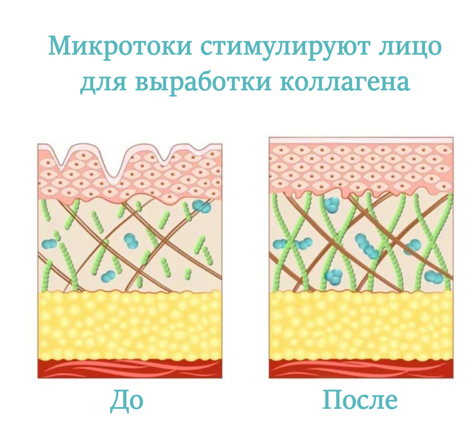 Схема микротоков для лица