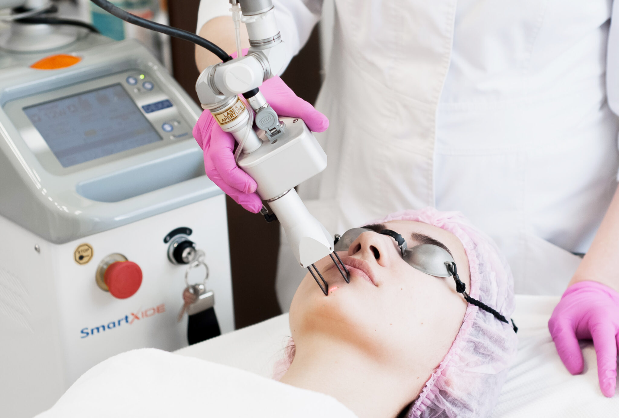 Удаление постакне лазером в Санкт-Петербурге | Клиника \"Отражение\"