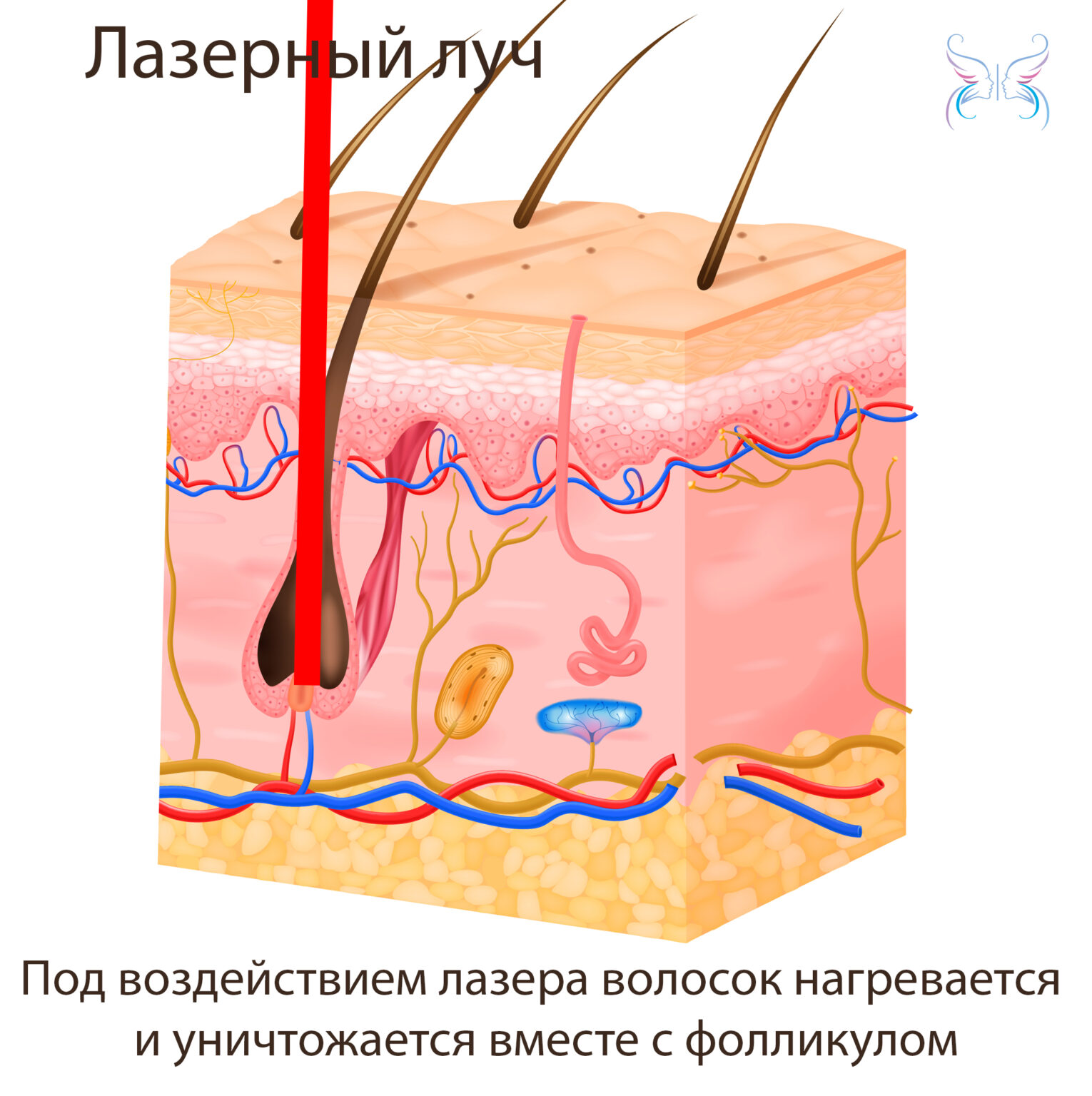 Бразильская эпиляция: что это такое? Эпиляция бикини, тотальное бикини ...