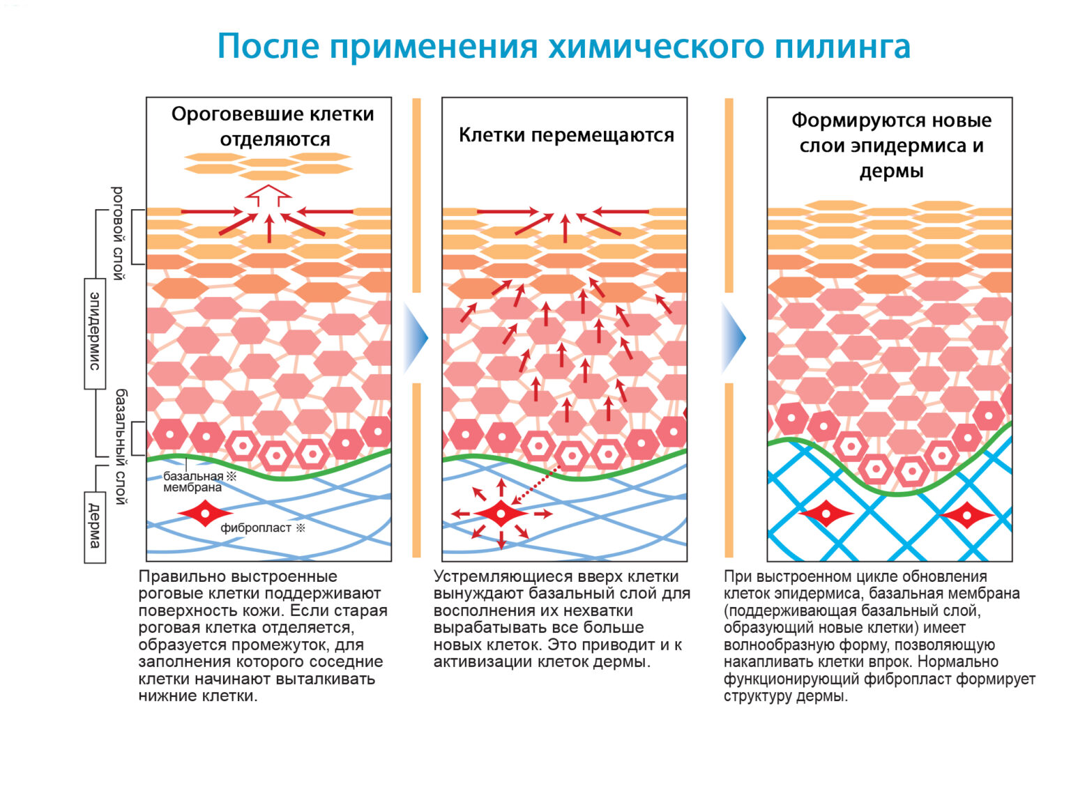 Отшелушивание рогового слоя эпидермиса кожи