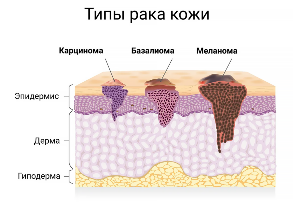 Народная медицина: почему рак опасно лечить травами или голоданием