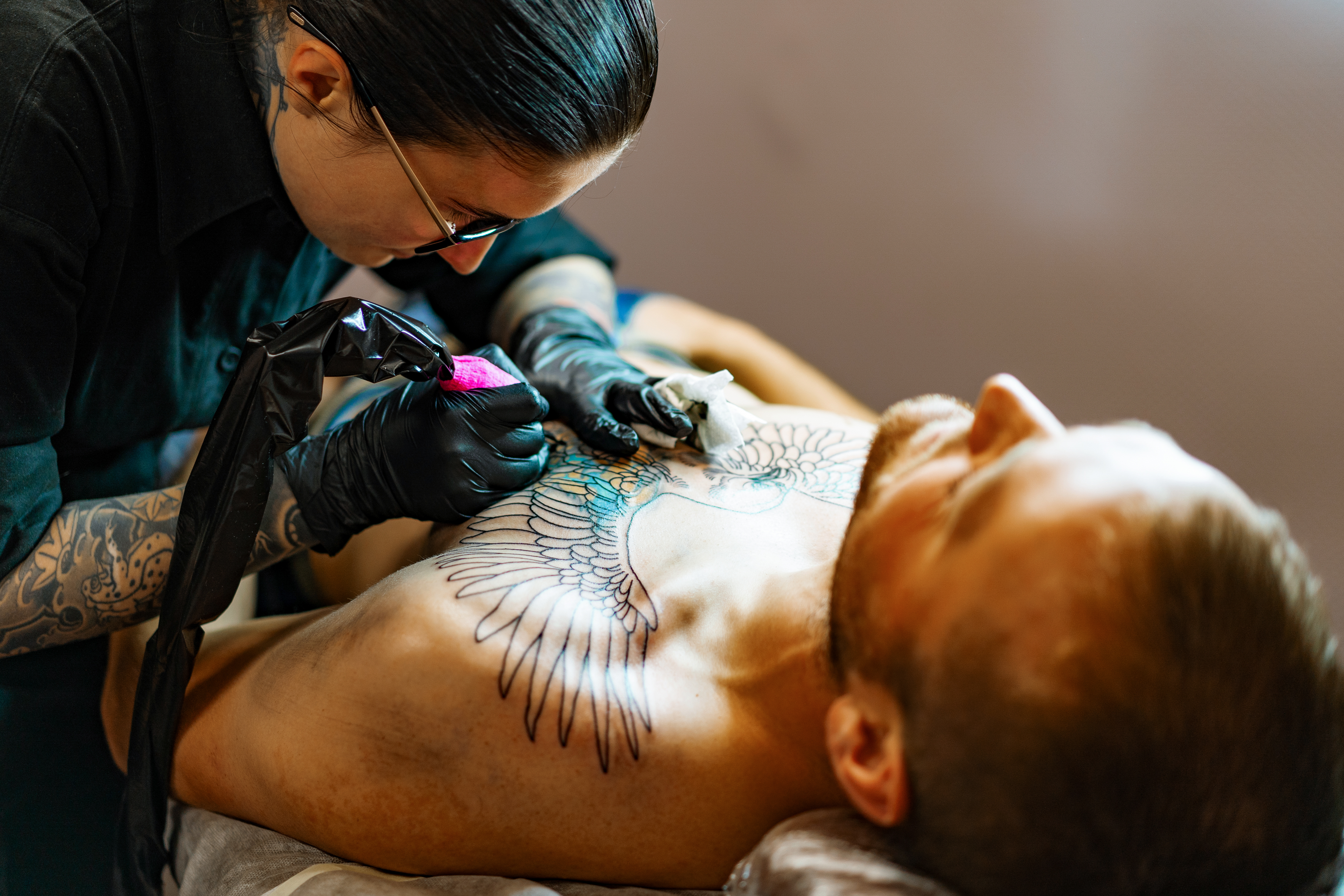 Лазерное удаление татуировки