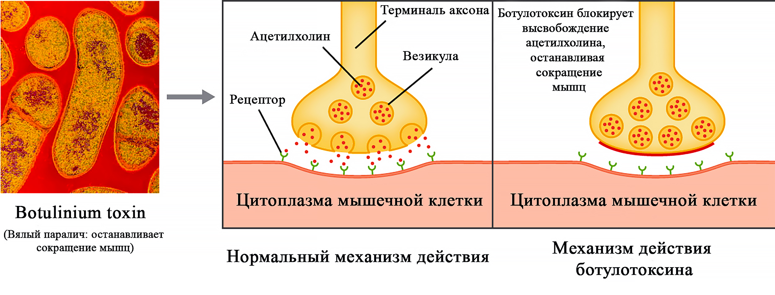 Механизм действия ботулотоксина