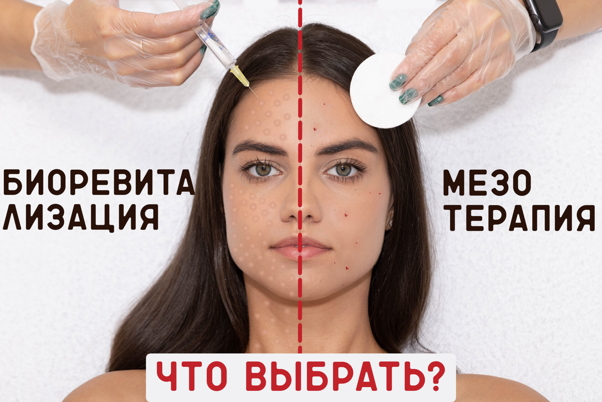 В чем отличие биоревитализации от мезотерапии? - Клиника "Отражение"