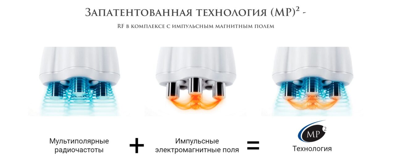RF-лифтинг: все о процедуре, как работает, уход, показания ...