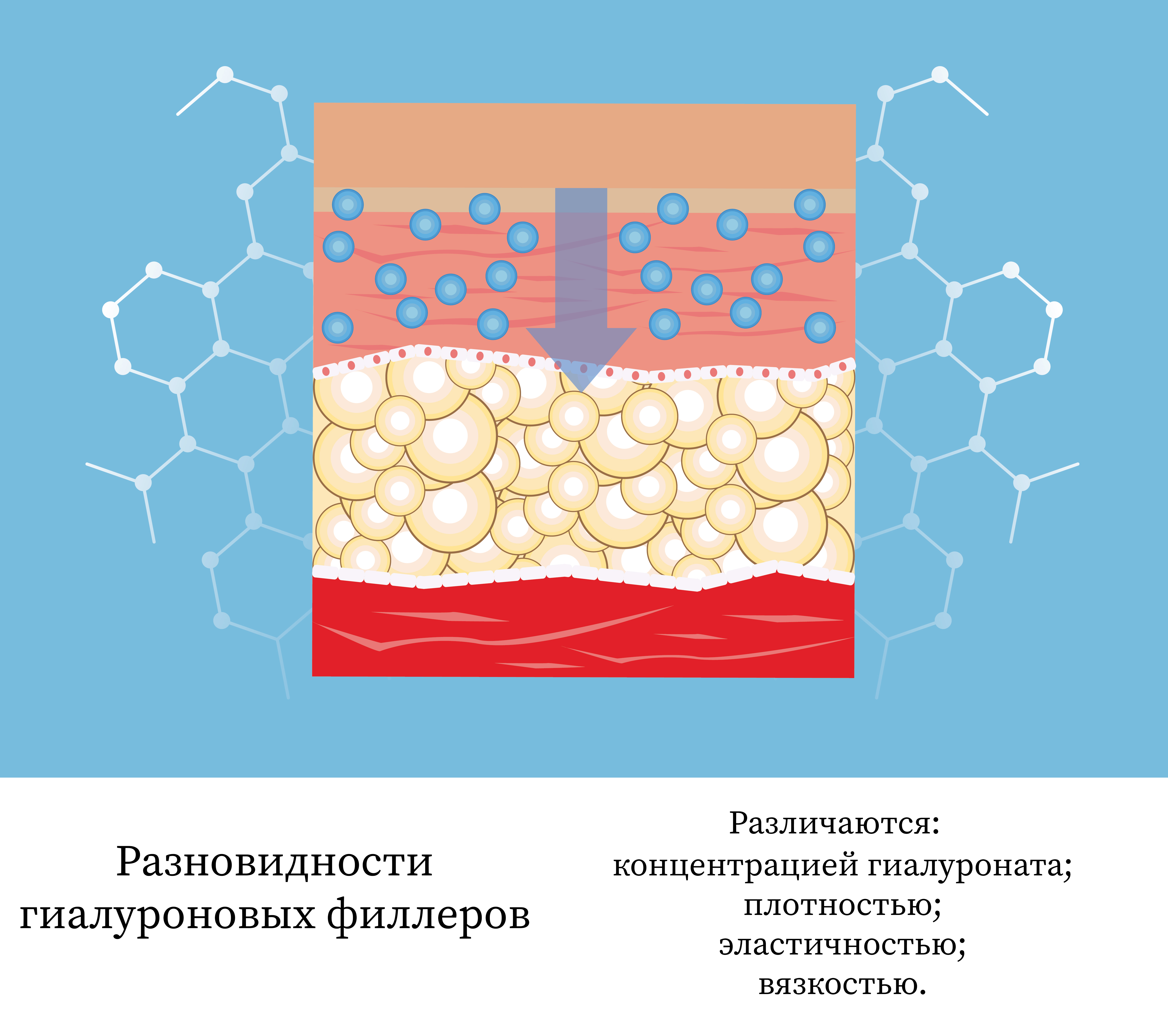 Существует немало гелей-наполнителей, которые различаются: концентрацией гиалуроната; плотностью; эластичностью; вязкостью