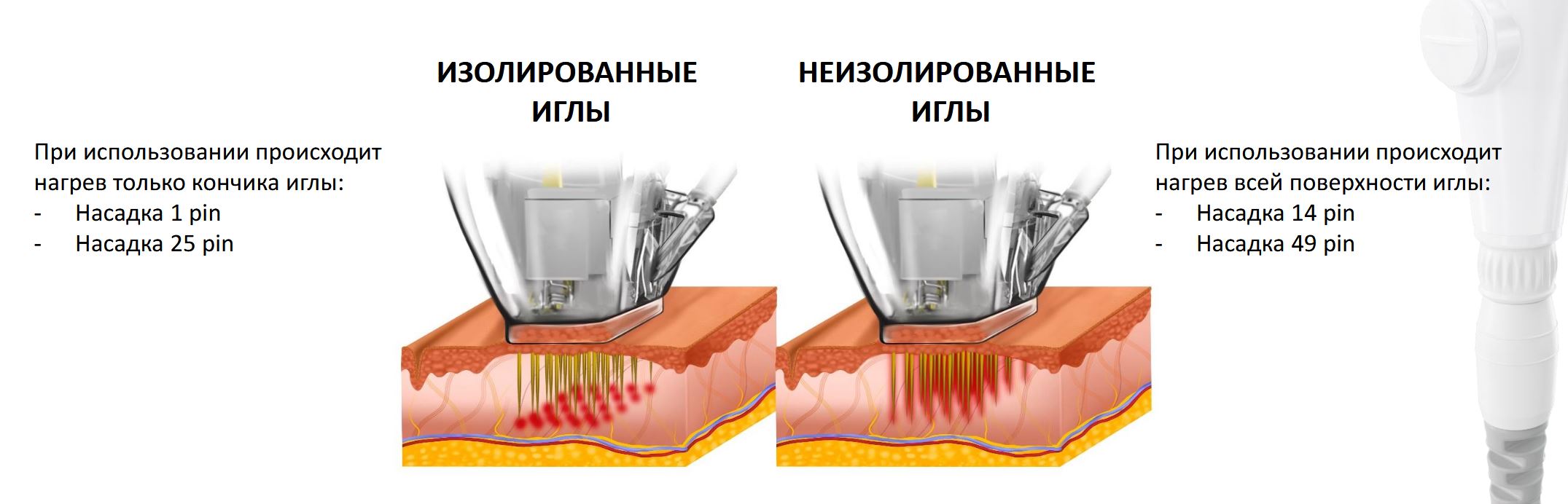 Виды микроигольчатого РФ-лифтинга