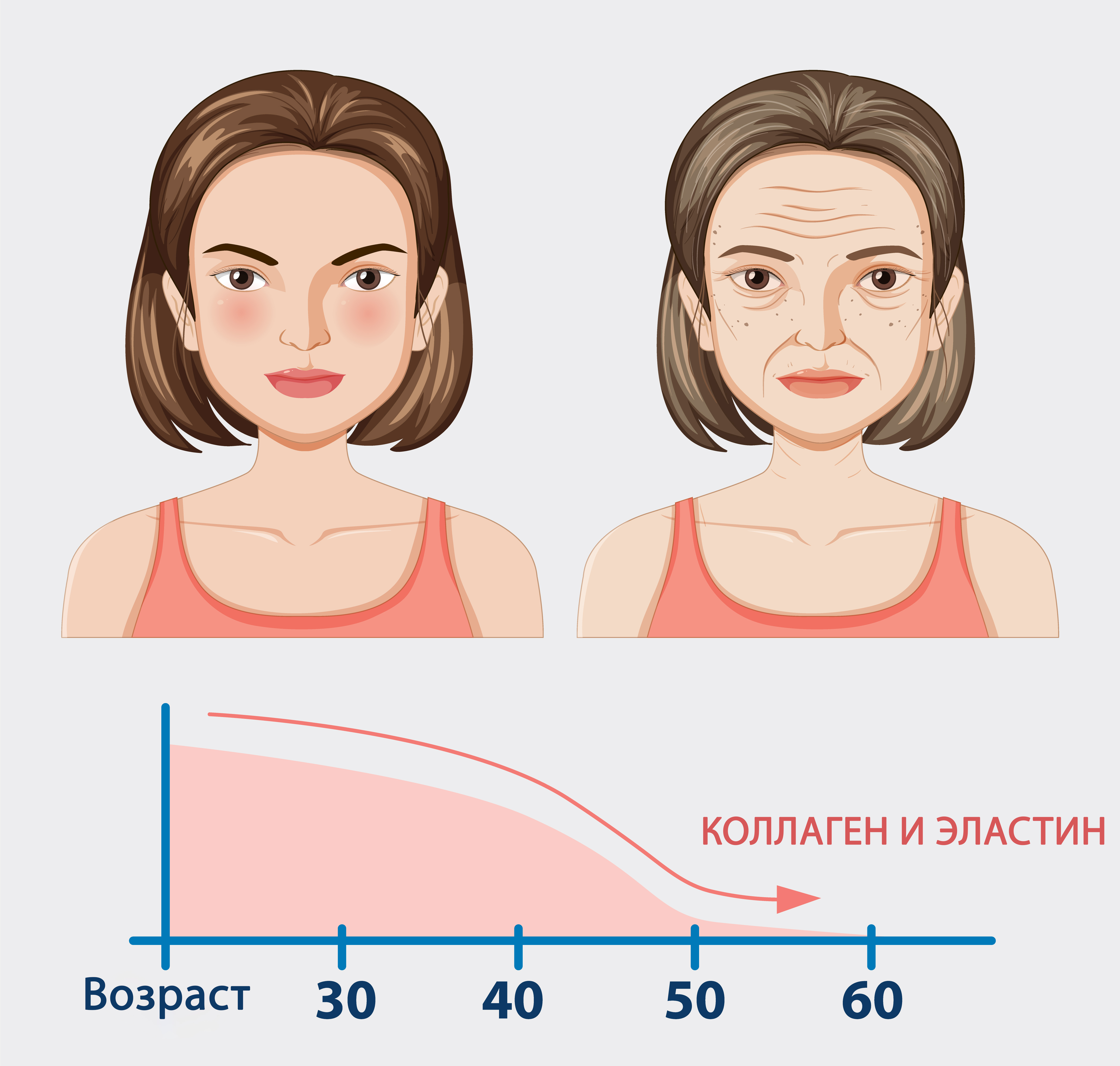 Причины и механизм развития старения кожи, связанного с коллагеном Причины и механизм развития старения кожи, связанного с коллагеном