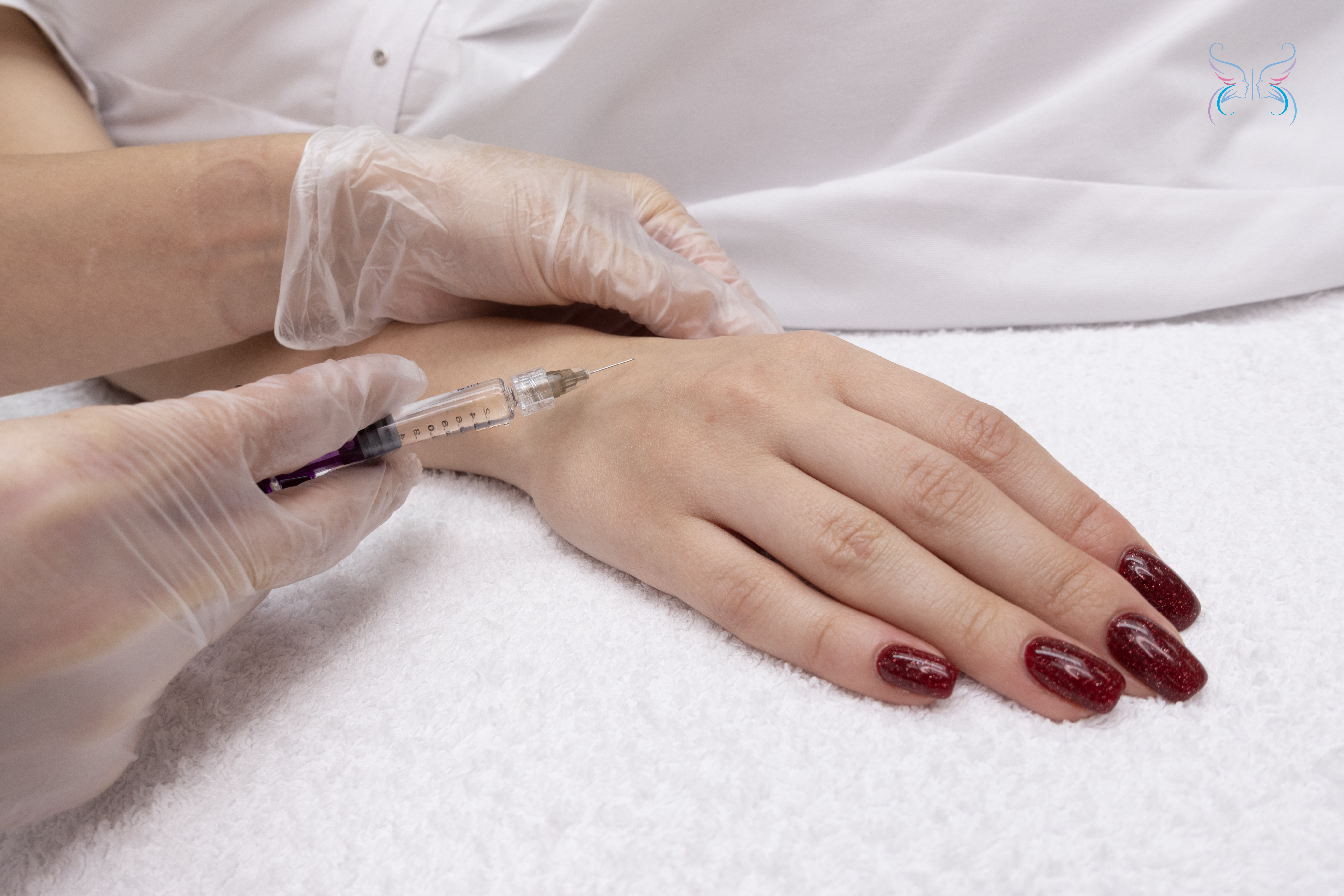 Гидроксиапатит кальция (CaHA). Введение филлера Radiesse. Препарат маскирует выступающие вены и сухожилия, восстанавливает объем, делает кожу более гладкой и молодой