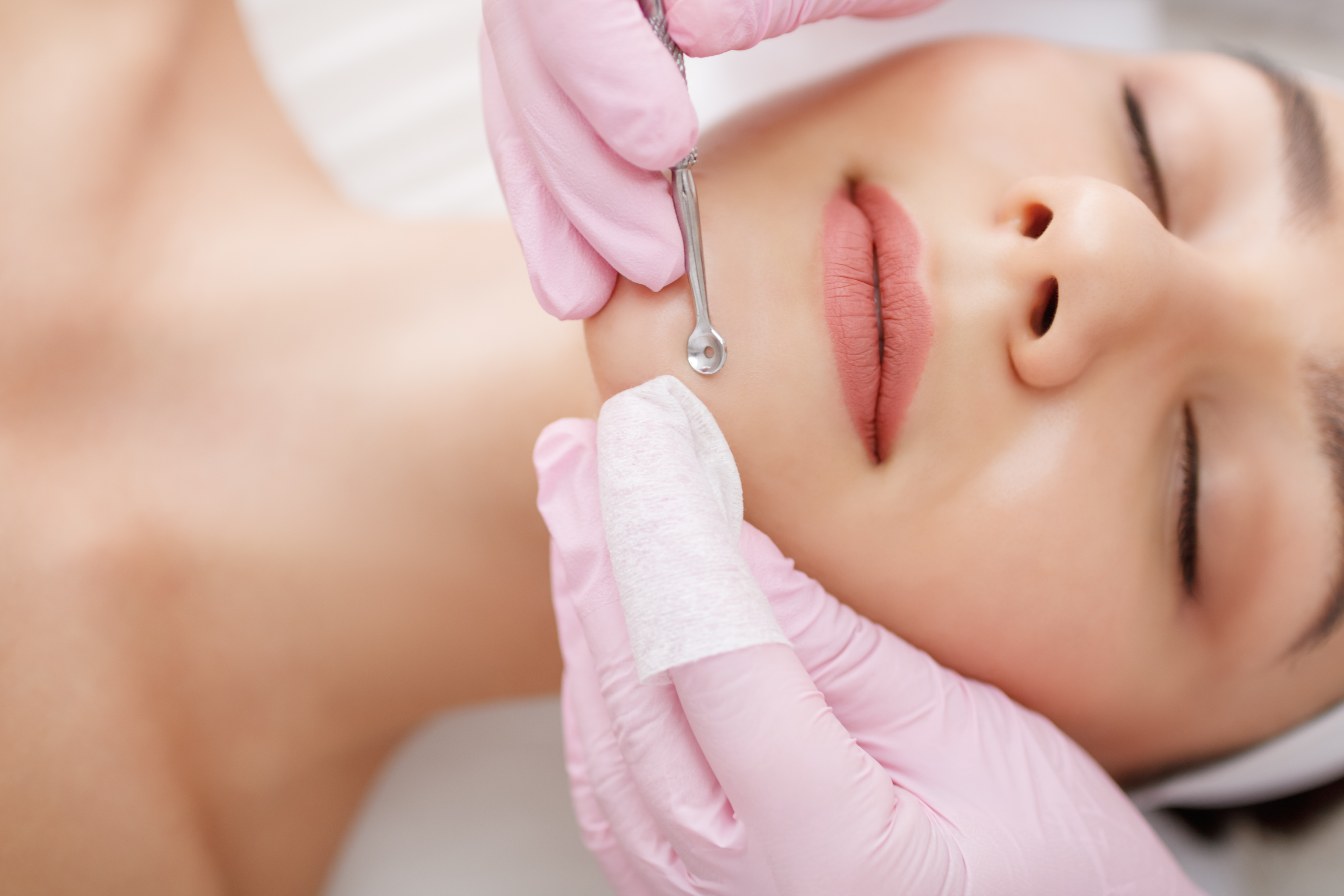 Дерматологическая (косметологическая) чистка лица