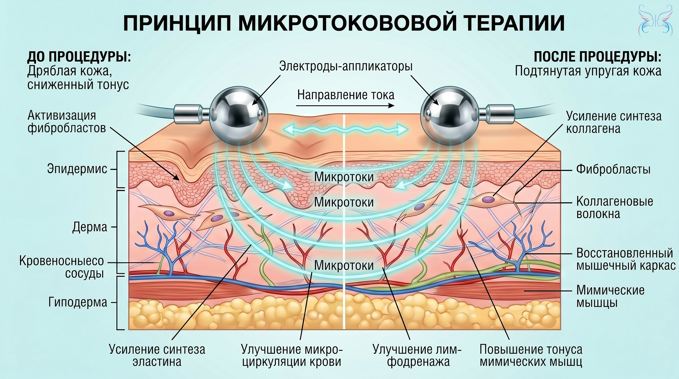 Микротоковая терапия Принцип действия