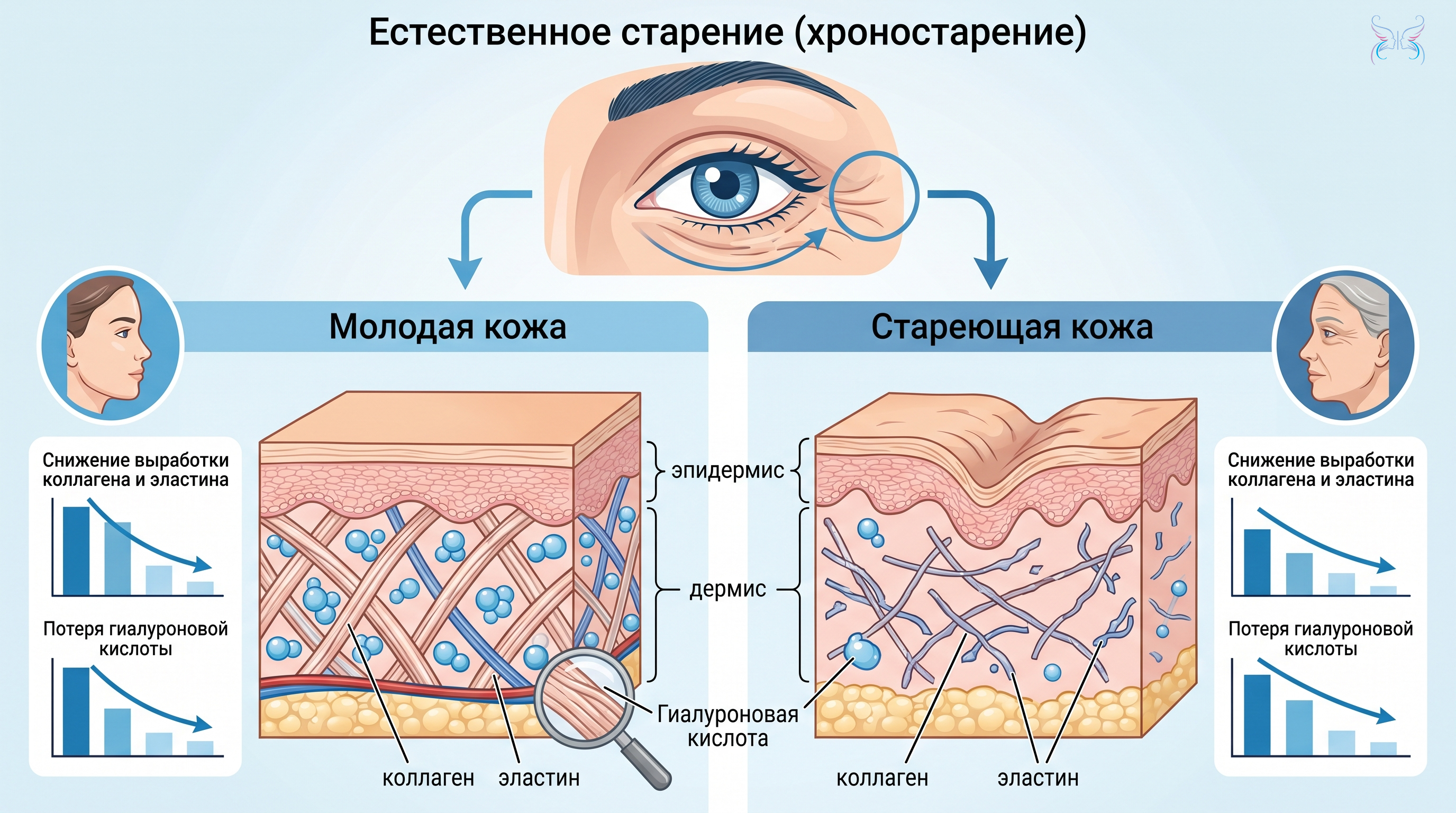 Естественное старение (хроностарение)